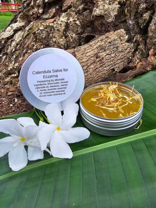 Calendula for Eczema